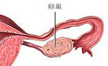 病毒疣